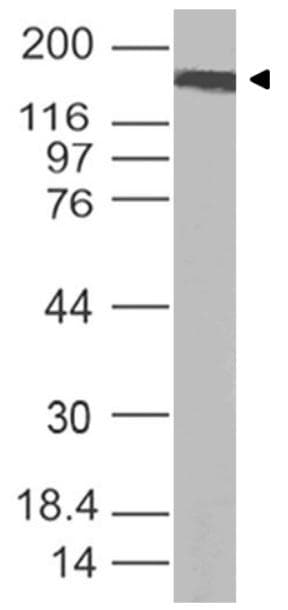 Polyclonal Rabbit anti-Coronavirus SARS-CoV-2 Spike Glycoprotein Antibody (850-1050 aa, WB)