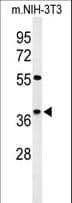 KLHDC2 / LCP Antibody (aa293-320)