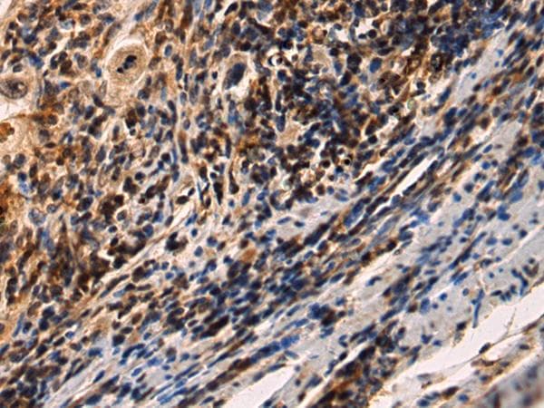 IRAK2 / IRAK-2 Antibody