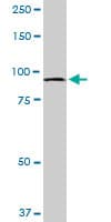 MTSS1 / MIM Antibody (clone 2G9)