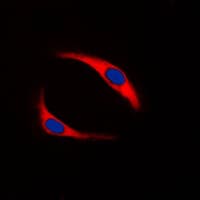 SYK Antibody (phospho-Tyr323)