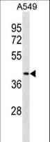 IHC-plus™ Renal Dipeptidase / DPEP1 Antibody (aa1-30)