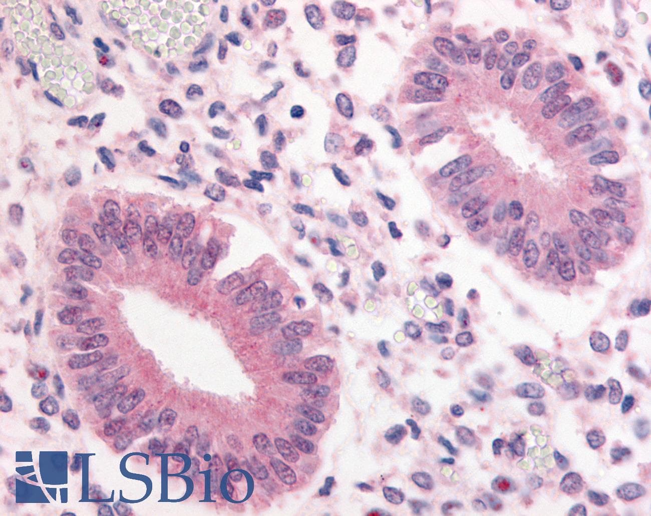 IHC-plus™ PDE3A Antibody (Internal)
