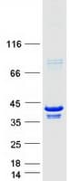 Human PARVG Protein (Recombinant Myc-DDK (Flag))