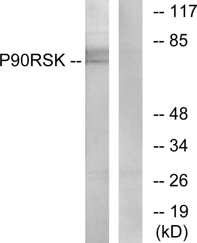 Polyclonal Rabbit anti-Human RPS6KA1 / RSK1 Antibody (aa539-588, IHC, IF, WB)