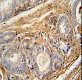 PCOTH Antibody (aa14-42)