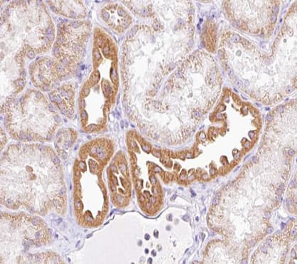 NRIP2 Antibody
