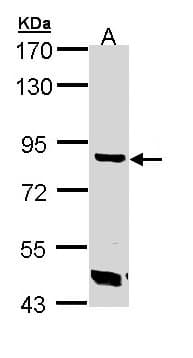 TREH Antibody (aa7-285)