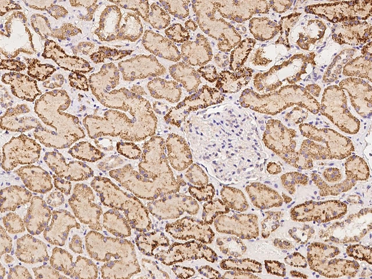 Polyclonal Rabbit anti-Human FPGS Antibody (IHC)