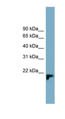 Polyclonal Rabbit anti-Human C1orf93 Antibody (aa137-186, WB)