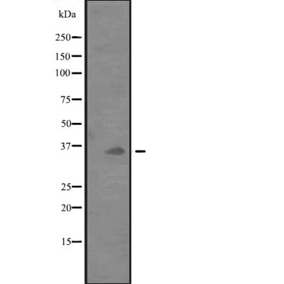 PD-L2 / PDCD1LG2 / CD273 Antibody