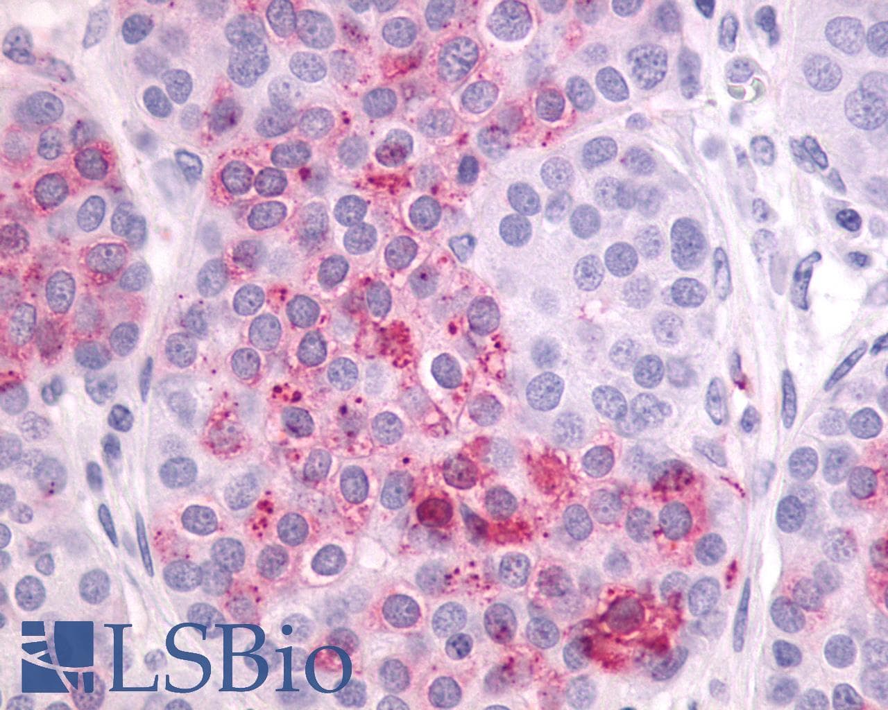 PathPlus™ LPAR4 / GPR23 Antibody (N-Terminus)