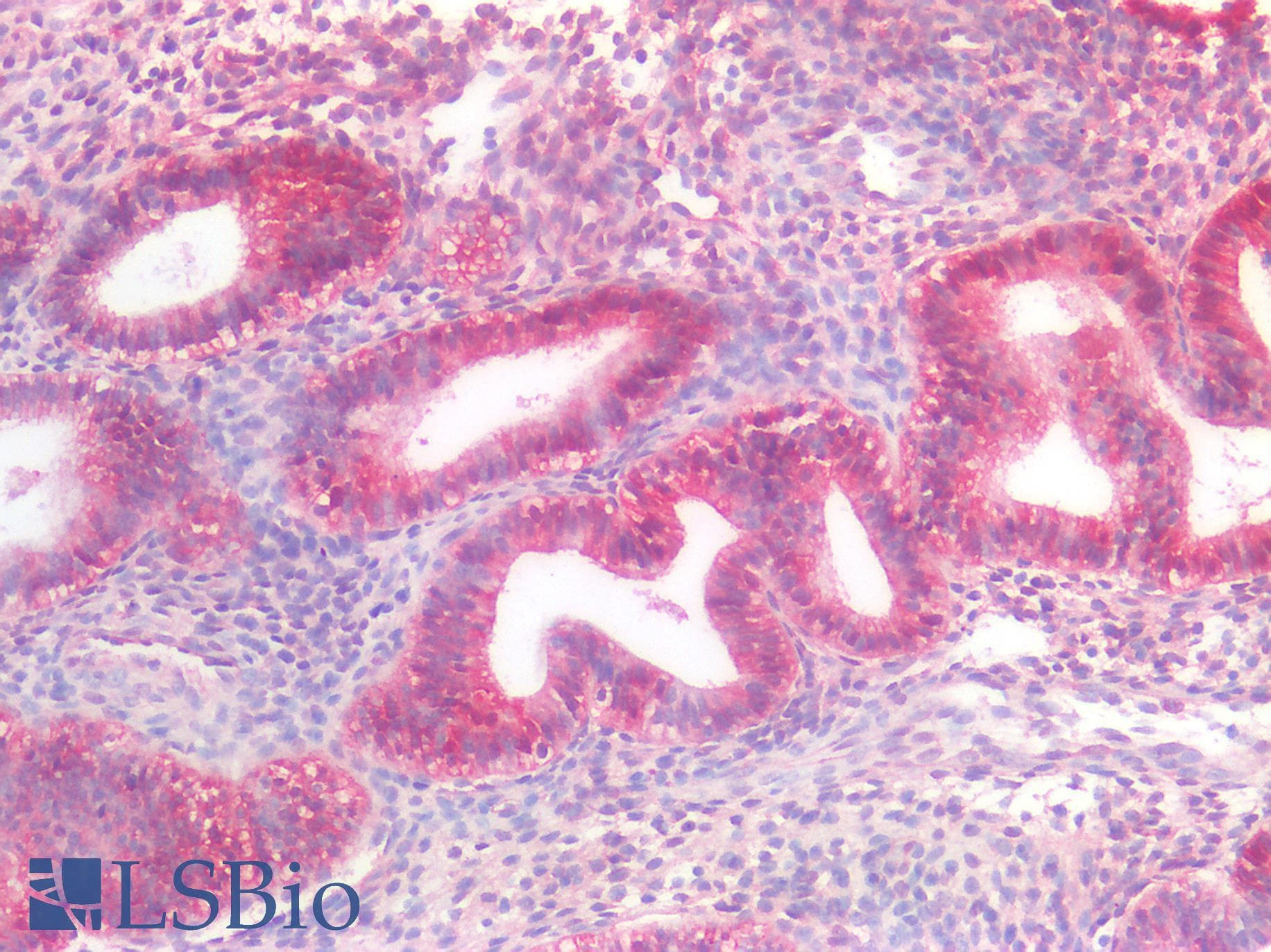 IHC-plus™ Monoclonal Mouse anti-Human CTNNB1 / Beta Catenin Antibody (IHC, WB)