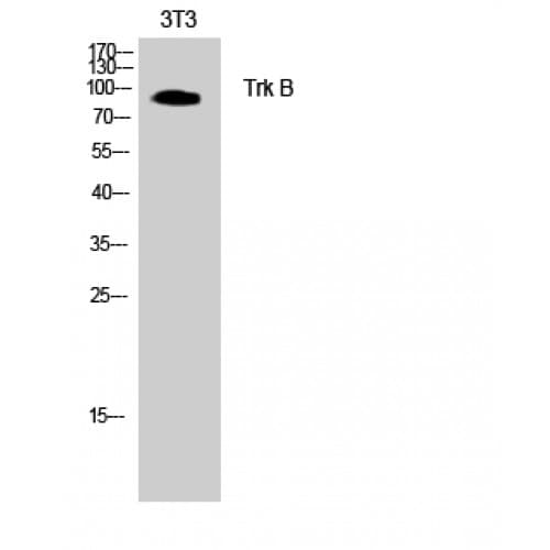 NTRK2 / TRKB Antibody (450-530 aa)
