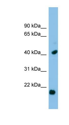 HSPB2 / HSP27 Antibody (C-Terminus)