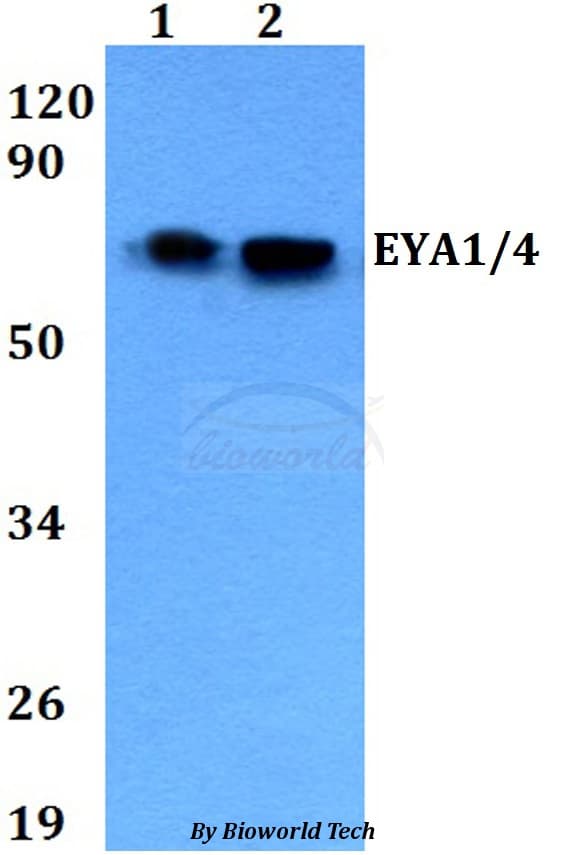 Polyclonal Rabbit anti-Human EYA1 Antibody (WB)