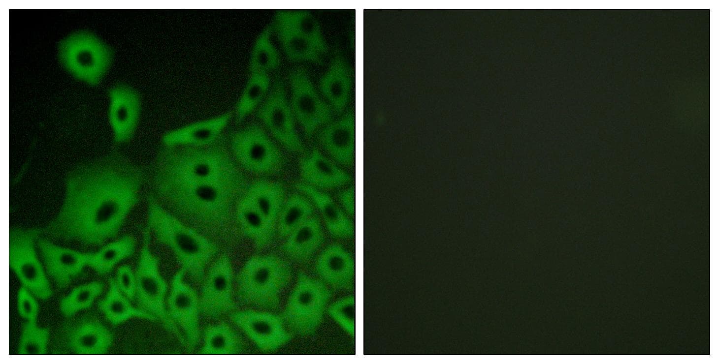 PGR1 / GPR153 Antibody