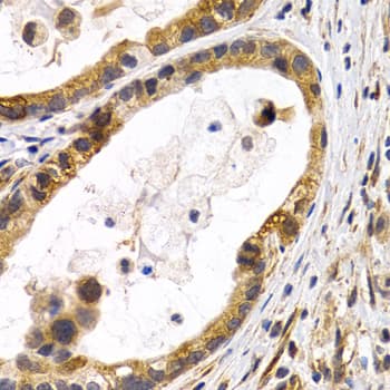 Polyclonal Rabbit anti-Human HSPB8 / H11 / HSP22 Antibody (IHC, IF, WB)