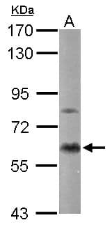 IHC-plus™ PRKCA / PKC-Alpha Antibody (aa1-250)