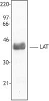 PathPlus™ LAT Antibody (Cytoplasmic Domain, clone LAT1111)