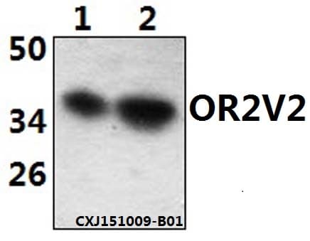 OR2V2 Antibody (aa229-274)