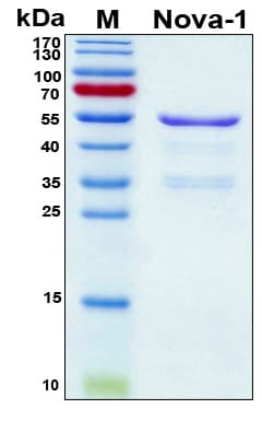 Human NOVA1 Protein (Recombinant 6His, N-terminus)