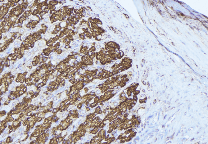 PRDX3 / Peroxiredoxin 3 Antibody