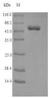Crab-eating macaque MBP / Myelin Basic Protein (Recombinant 6His-SUMO, N-terminus)