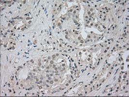 Monoclonal Mouse anti-Human NTRK3 / TRKC Antibody (clone OTI4E10, IHC, IF, WB)
