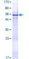 Human KIAA0825 Protein (Recombinant GST)