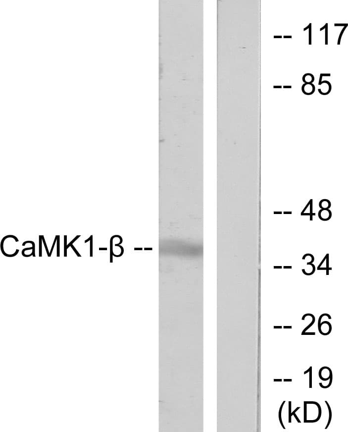 PNCK / CaMK1b Antibody (aa161-210)