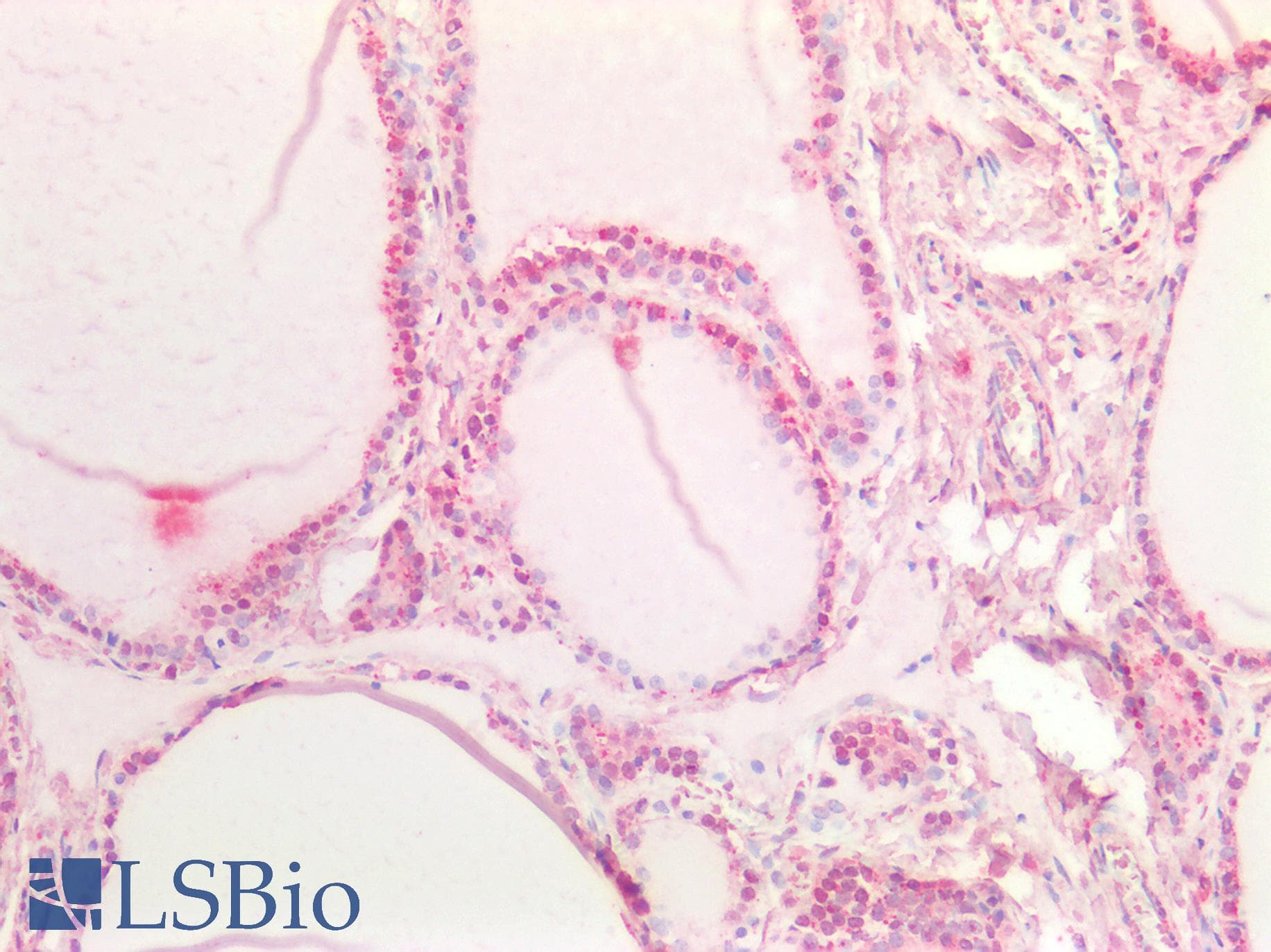 IHC-plus™ Polyclonal Goat anti-Human NOTCH1 Antibody (Amino Acids 171-182, IHC, IF)
