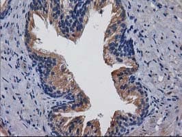 CDCP1 Antibody (clone OTI3B5)