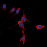 Polyclonal Rabbit anti-Human KCNJ3 / GIRK1 Antibody (Internal, IF, WB)