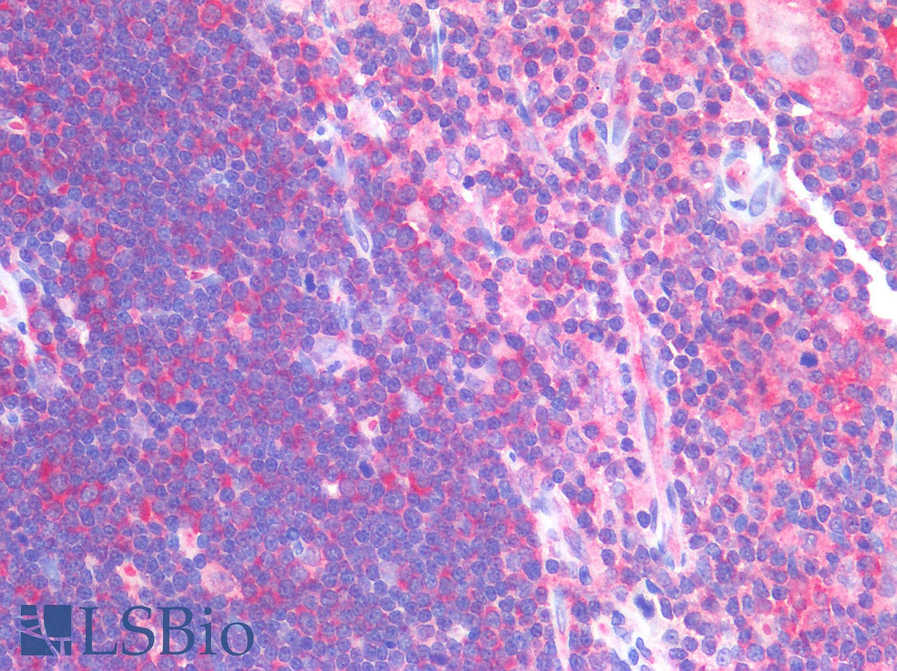 IHC-plus™ Polyclonal Rabbit anti-Human TP53 / p53 Antibody (IHC)