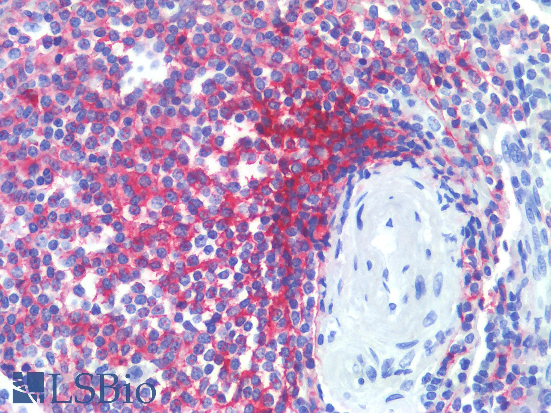 PathPlus™ Monoclonal Mouse anti-Human CR1 / CD35 Antibody (clone E11, Azide-free,BSA-free, IHC, IF)