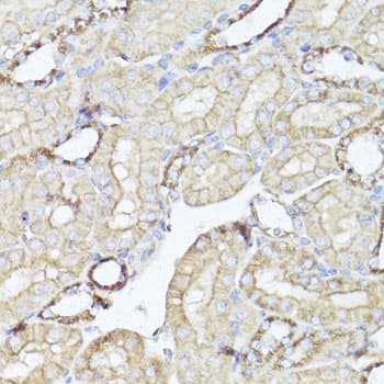 OPRK1 / Kappa Opioid Receptor Antibody