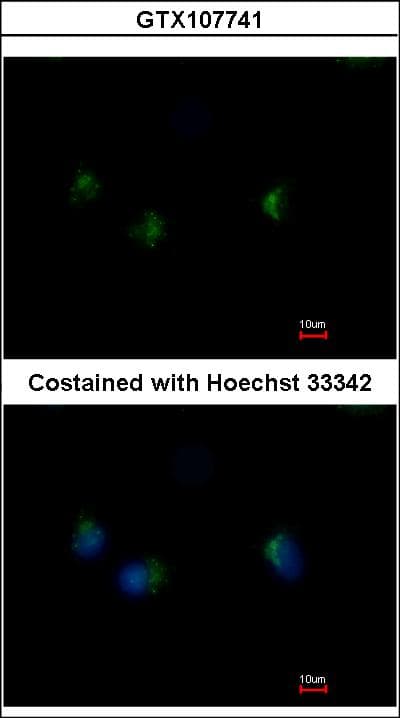 Polyclonal Rabbit anti-Human STK26 / MST4 Antibody (aa352-416, IHC, WB)