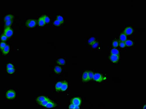 SIK1 / MSK Antibody