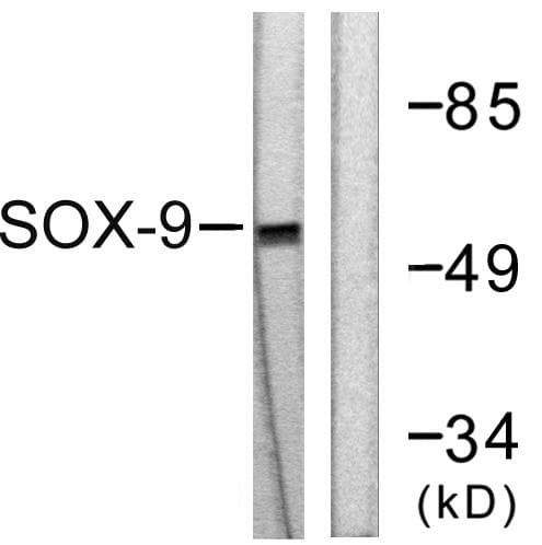 Polyclonal Rabbit anti-Human SOX9 Antibody (p181, IHC, IF, WB)