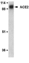 PathPlus™ Polyclonal Rabbit anti-Human ACE2 / ACE-2 Antibody (IHC, IF, WB)