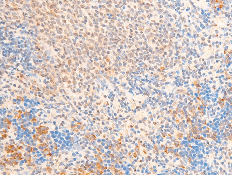 Polyclonal Rabbit anti-Human FOXO3 / FOXO3A Antibody (phospho-Ser253, IHC, WB)