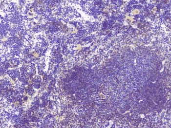 HAS1 / HAS Antibody