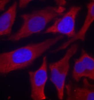 SYN1 / Synapsin 1 Antibody (phospho-Ser9)