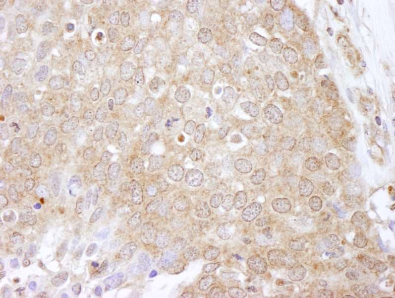 Polyclonal Rabbit anti-Human EEF2K Antibody (aa675-725, IHC, IF)