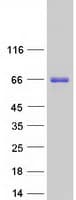 Human BTBD9 Protein (Recombinant Myc-DDK (Flag))