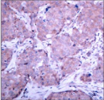 Polyclonal Rabbit anti-Human PTEN Antibody (IHC, IF)