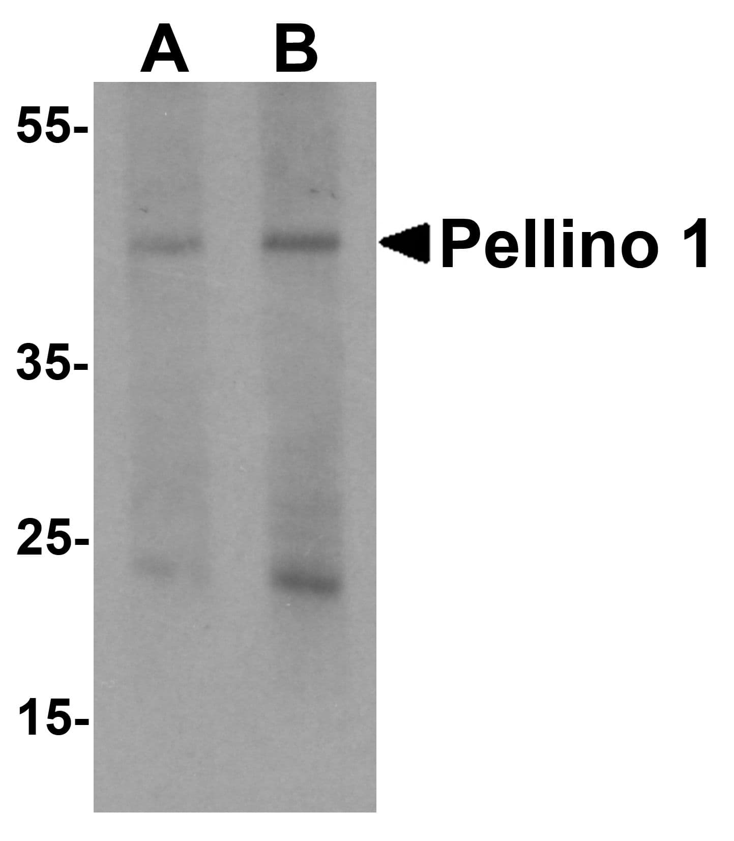 IHC-plus™ PELI1 / Pellino 1 Antibody