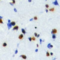 NOL8 Antibody (C-Terminus)