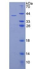 Human Proinsulin Protein (Recombinant His-GST, N-terminus)